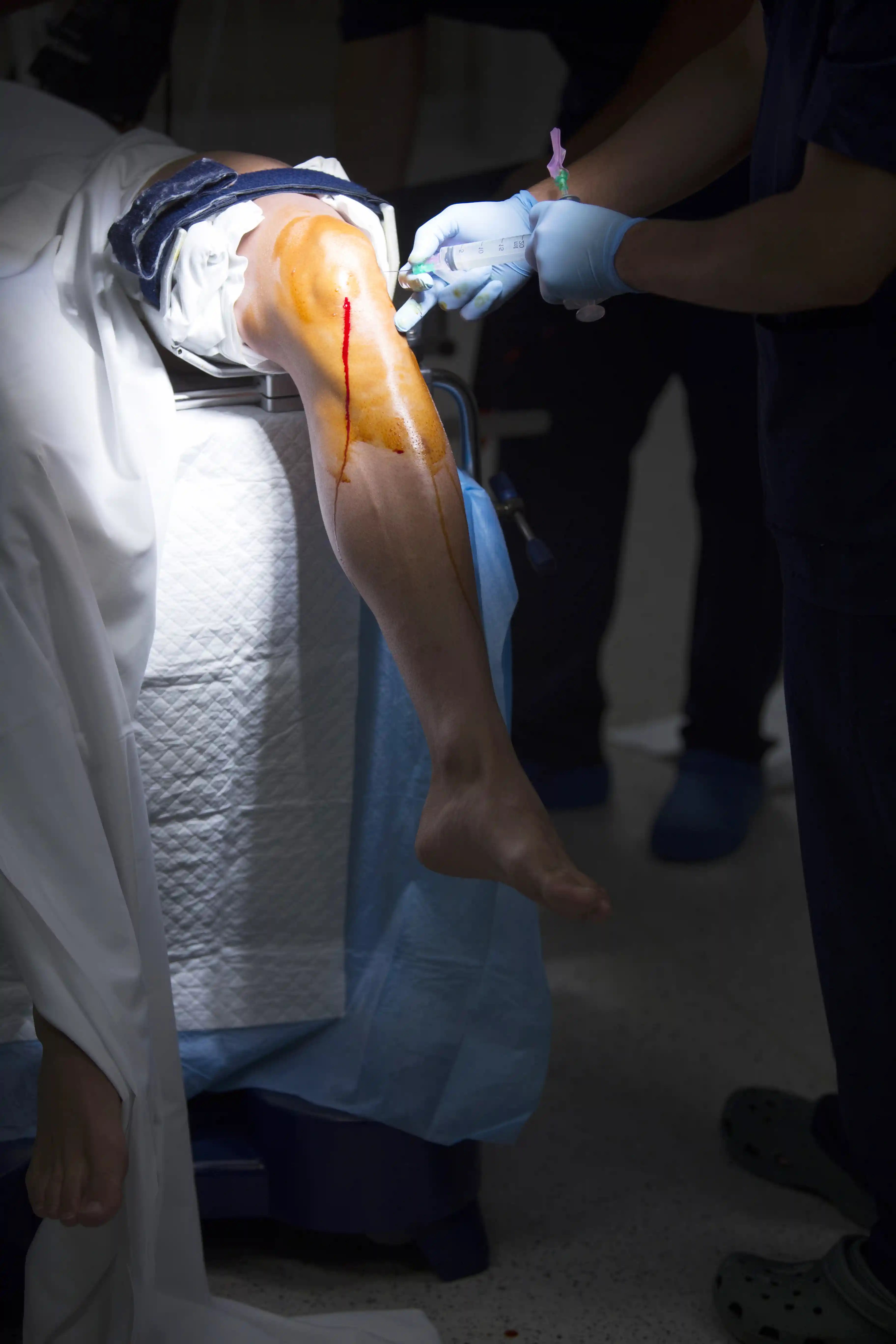 Arthroscopy (Keyhole) — Knee, Shoulder, Ankle & Hip